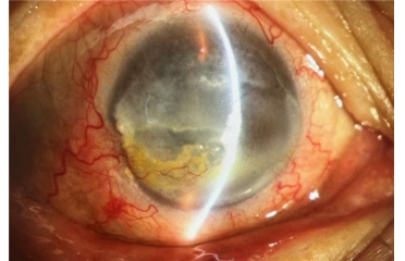 ���������U׃�p��ʧ�����۠�Ӣ���ۿ���B�����ڸ��y�����g(sh��)��ҕ��